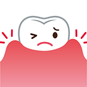 歯周疾患の改善